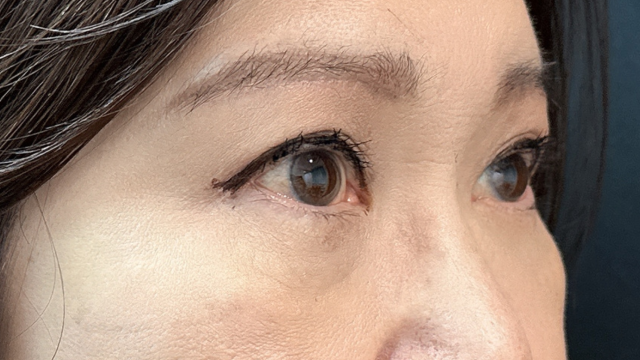 Postoperative Condition Part 1