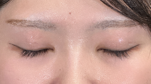 手术后的状态 其一