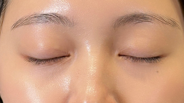 手术后的状态 其一