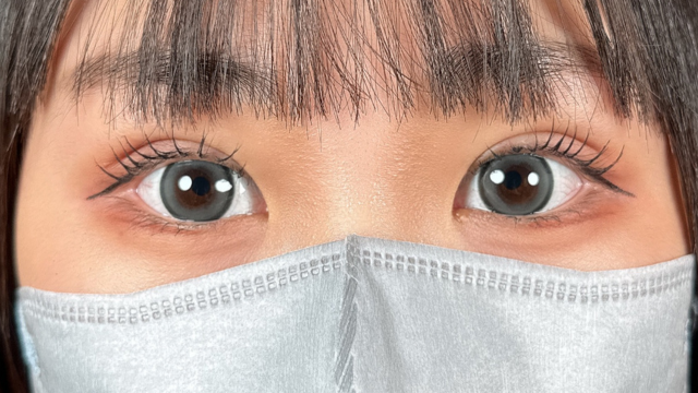 手术后的状态 其一