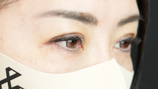 Postoperative Condition Part 1