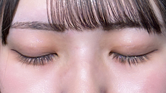 手术后的状态 其一