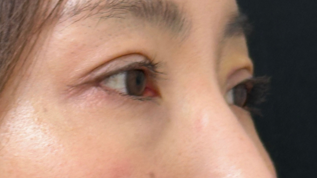 Postoperative Condition Part 1