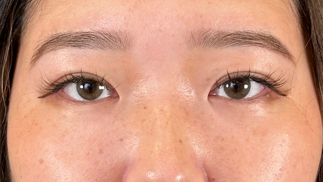 手术后的状态 其一