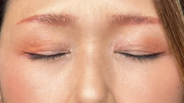 Postoperative Condition Part 1