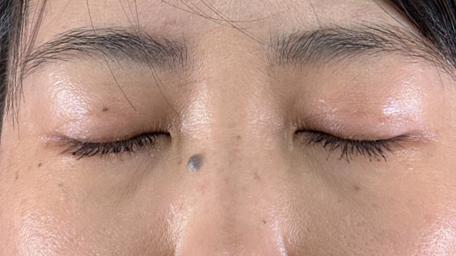 Postoperative Condition Part 1