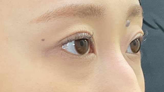 手术后的状态 其一