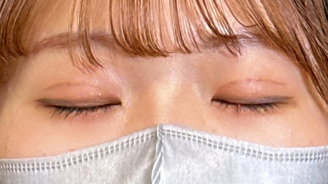 手术后的状态 其一