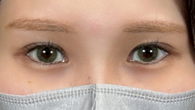 手术后的状态 其一