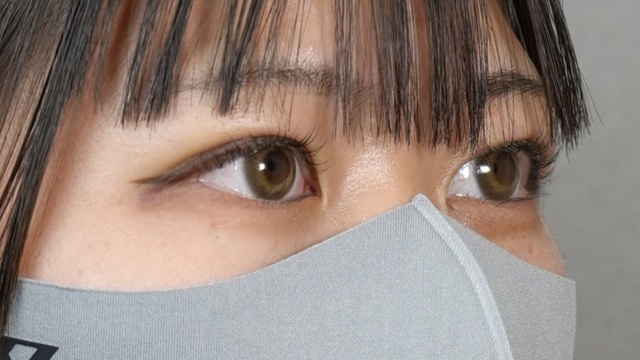 手术后的状态 其一