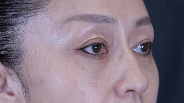 Postoperative Condition Part 1