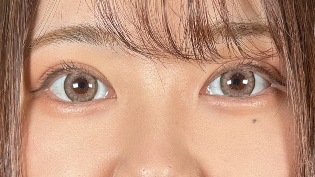 手术后的状态 其一