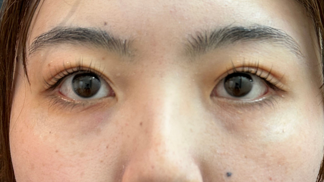 Postoperative Condition Part 1