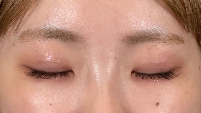 Postoperative Condition Part 1