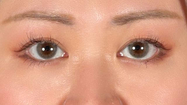 Postoperative Condition Part 1