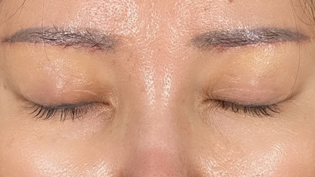 Postoperative Condition Part 1