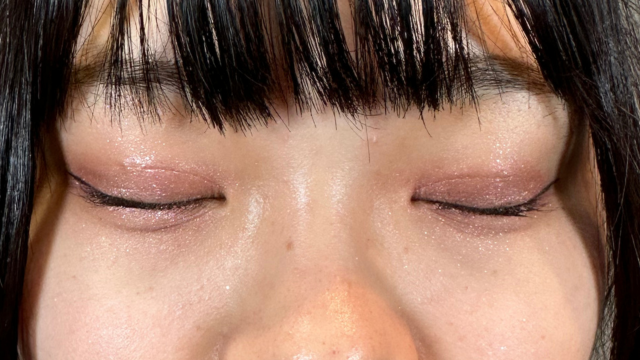 手术后的状态 其一