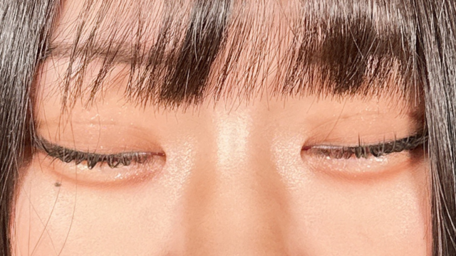 手术后的状态 其一