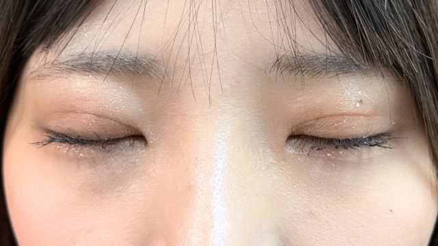 手术后的状态 其一