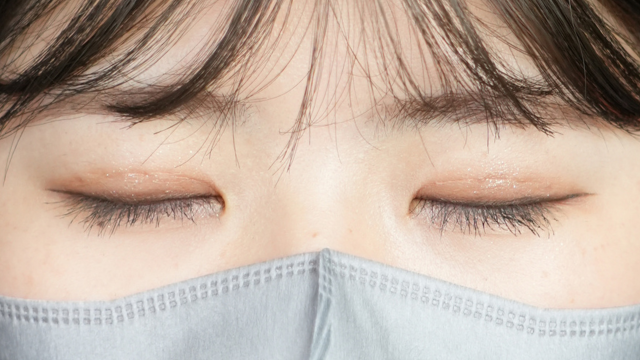 手术后的状态 其一