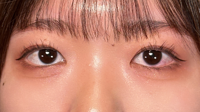 手术后的状态 其一