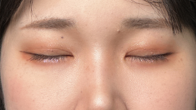 Postoperative Condition Part 1