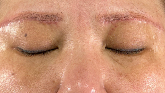 Postoperative Condition Part 1