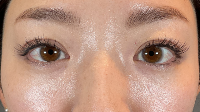 手术后的状态 其一