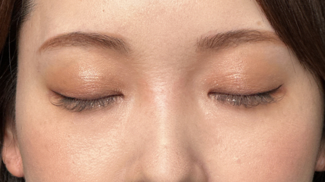 手术后的状态 其一