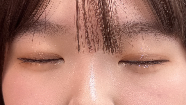 手术后的状态 其一