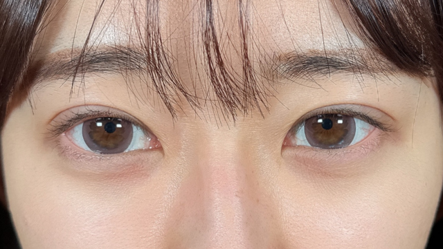 手术后的状态 其一