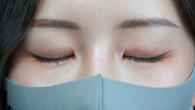 手术后的状态 其一