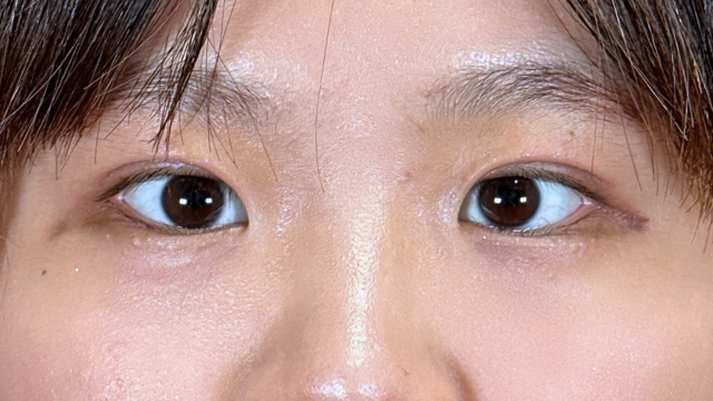 Postoperative Condition Part 1