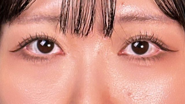 手术后的状态 其一