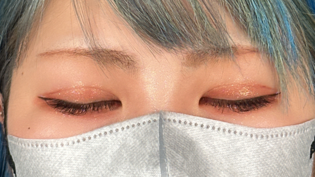 手术后的状态 其一