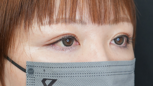 Postoperative Condition Part 1