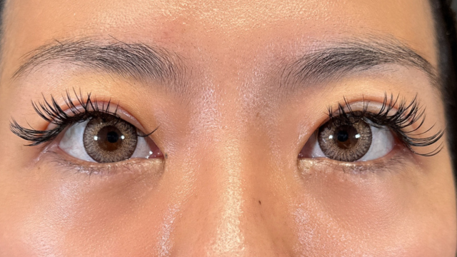 Postoperative Condition Part 1