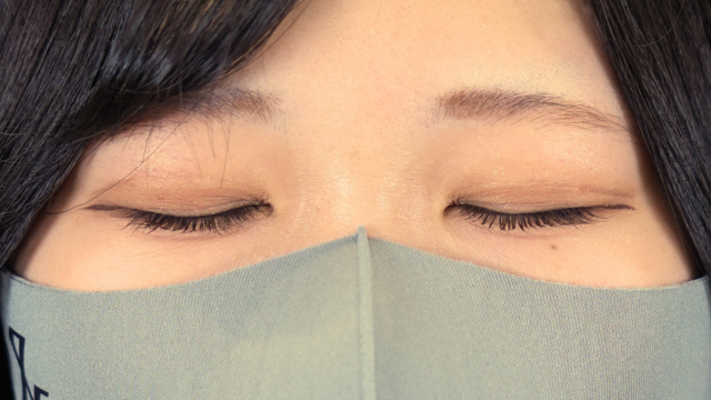 手术后的状态 其一