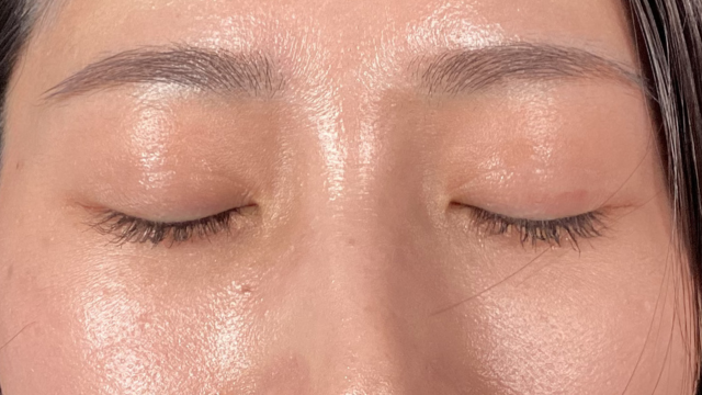 手术后的状态 其一