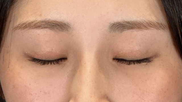 手术后的状态 其一