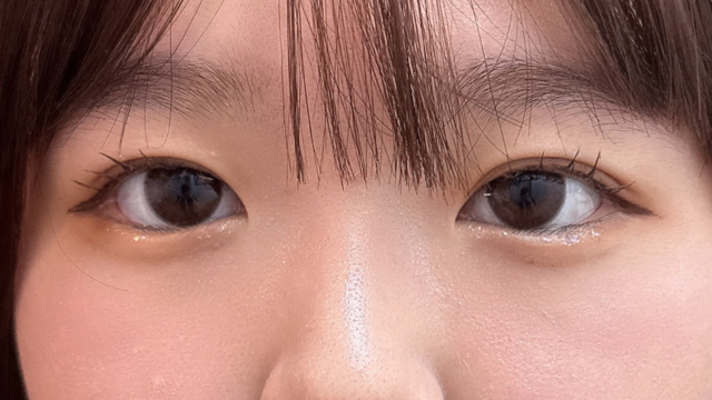 手术后的状态 其一