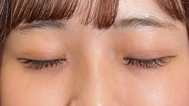 Postoperative Condition Part 1