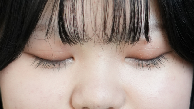 手术后的状态 其一