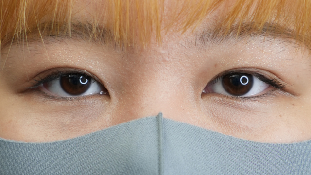 Postoperative Condition Part 1