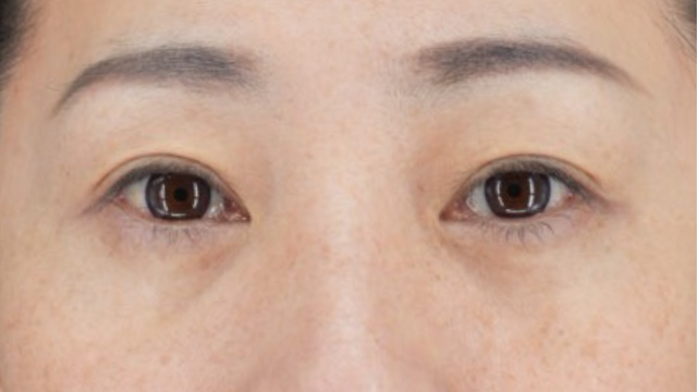 手术后的状态 其一