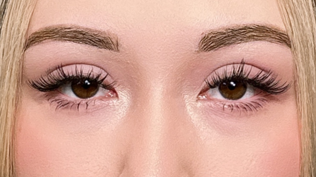 手术后的状态 其一