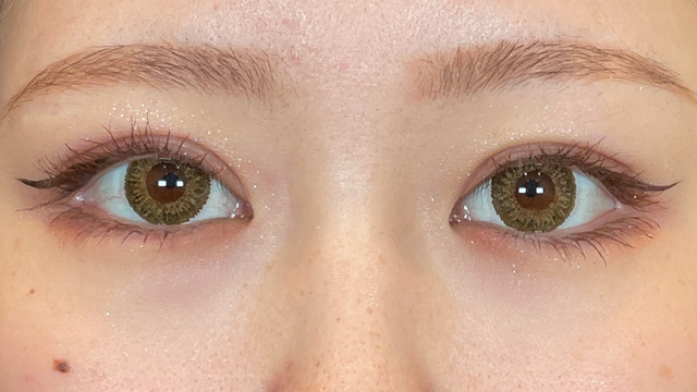 Postoperative Condition Part 1