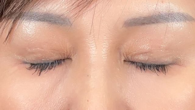 Postoperative Condition Part 1