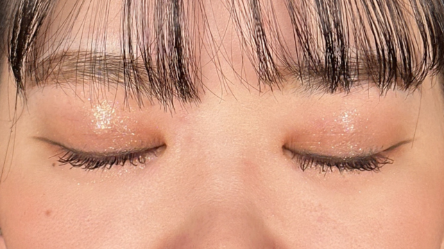 手术后的状态 其一