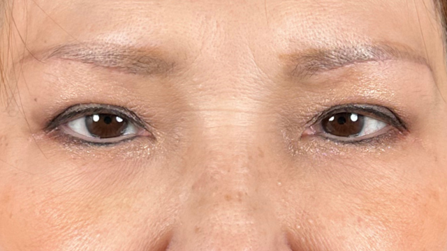 Postoperative Condition Part 1